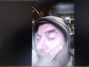 Dupuytren disease affects the hands